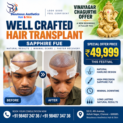 Well Crafted Hair Transplant in Chennai Sapphire FUE Vinayagar Chaturthi Offer