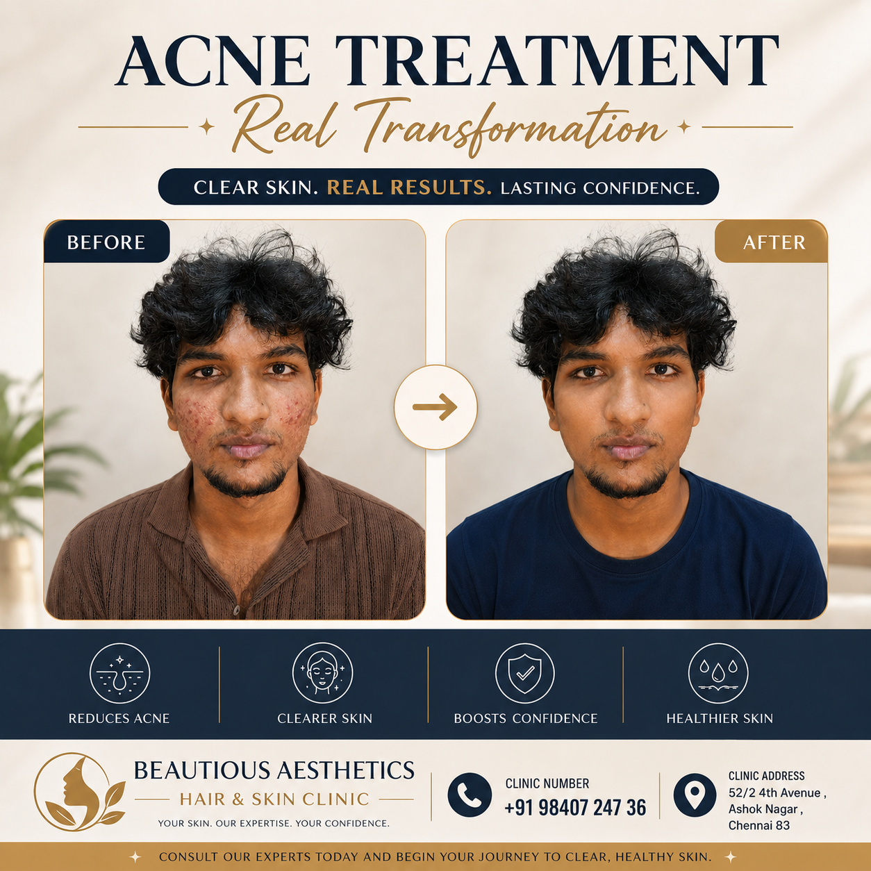 PRP Therapy