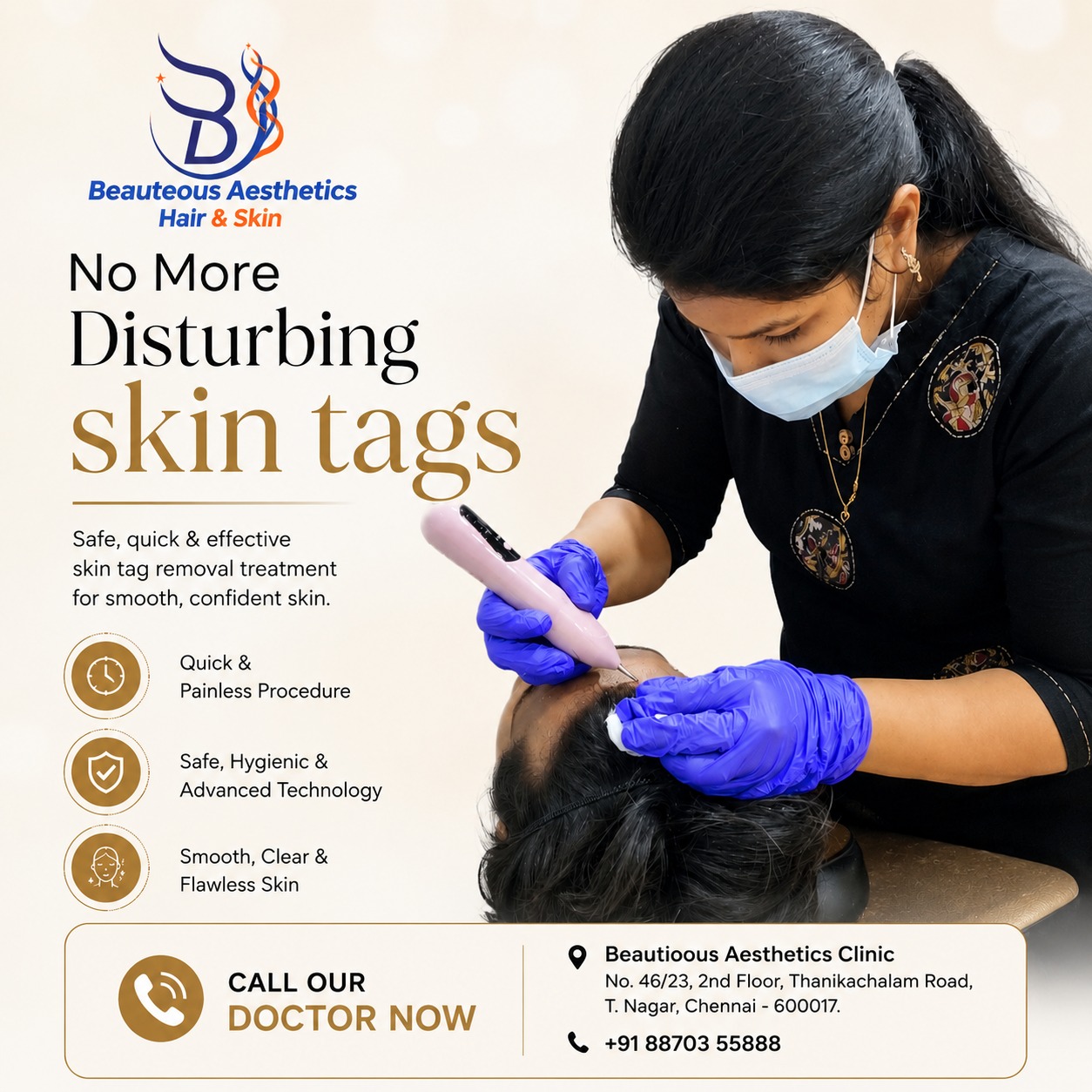 Skin Tag Removal in Chennai: Professional Treatment for Unwanted Skin Tags